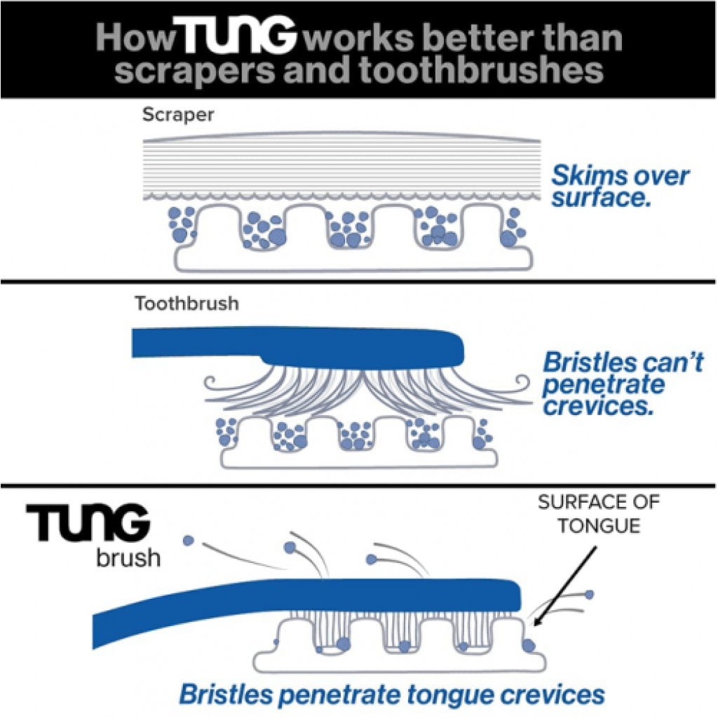 فرشاة تنظيف اللسان من تنج