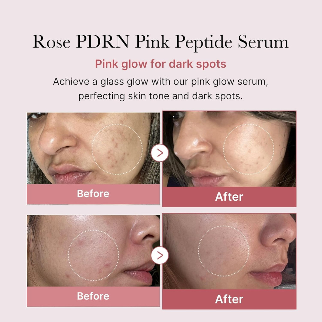Medicube PDRN PINK PEPTIDE SERUM السيروم الوردي لتفتيح البشرة ومكافحة التجاعيد