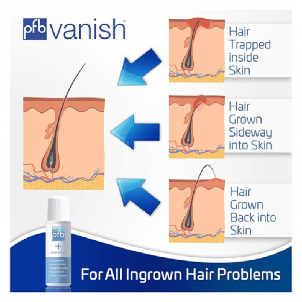 سيروم تفتيح البشرة كرومابرايت من بي اف بي فانش - 93ج