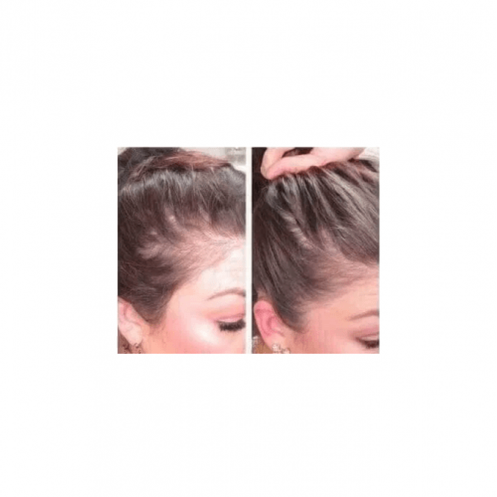 زيت غرو لتقوية الشعر من د. ميراكلز - 118مل